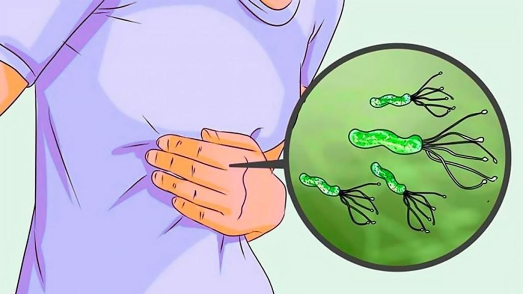 helicobacter pylori, es un bacteria mutada, que se alimenta de tus toxinas, ponle fin con un tratamiento natural e integral de salud.