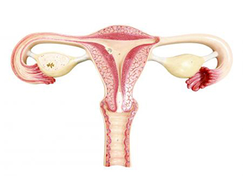Dolor ciclo menstrual y colon irritable