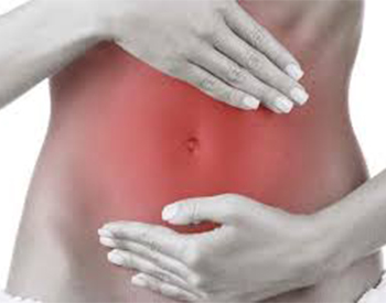 Hinchazon por colon irritable